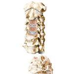 Degenerative Changes in Cervical Vertebrae