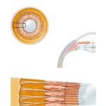 Lens and Supporting Structures