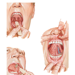 Inspection of Oral Cavity
