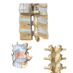 Vertebral Ligaments: Lumbar Region