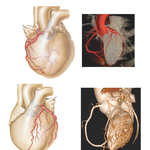 Coronary Arteries: Imaging