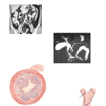 CT and MRCP Showing Appendix, Gallbladder, and Ducts; Nerve Branches of Hepatic Artery