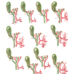 Variations in Cystic Arteries