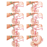 Variations in Celiac Trunk