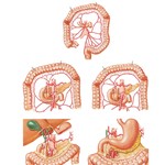 Variations in Colic Arteries (continued)
