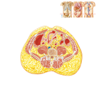 Transverse Section of Abdomen: Level of L5, Near Transtubercular Plane