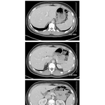 Abdominal Scans: Axial CT Images