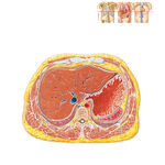 Cross Section at T10, Esophagogastric Junction