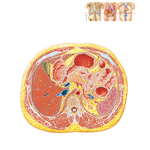 Cross Section at T12, Inferior to Xiphoid
