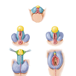 Homologues of External Genitalia