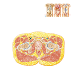Male Pelvis: Cross Section of Bladder-Prostate Gland Junction