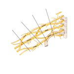 Brachial Plexus: Schema