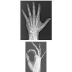 Wrist and Hand: Radiographs