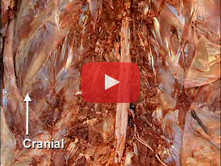 Vertebral Column and Its Contents: Step 3. Spinal cord, conus medullaris, internal filum terminale, 