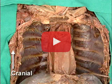 Posterior Mediastinum, Azygos System: Step 1. Vagus and recurrent laryngeal nerves  