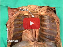 Posterior Mediastinum, Azygos System: Step 2. Relationship of the esophagus to the tracheal bifurcat