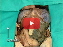 Anterior Abdominal Wall and Abdominal Viscera in situ: Step 12. Abdominal viscera in situ  