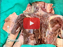 Posterior Shoulder: Step 2. Rhomboid major, rhomboid minor, and levator scapulae muscles; accessory 