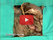 Stomach, Duodenum, Portal System, and Inferior Mesenteric Artery: Step 9. Duct system within the pan