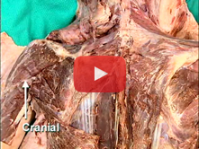 Posterior Shoulder: Step 3. Innervation of the rhomboid and latissimus dorsi muscles; the dorsal sca