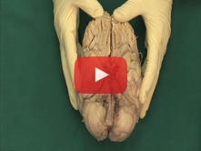 Brain: Step 7. Middle, anterior and posterior cerebral arteries