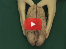 Brain: Step 8. Midsagittal section of the brain