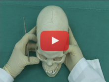 Osteology of the Head and Neck: Step 7. Cranial sutures  