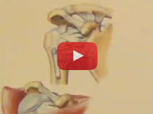 Shoulder with Brion Benninger